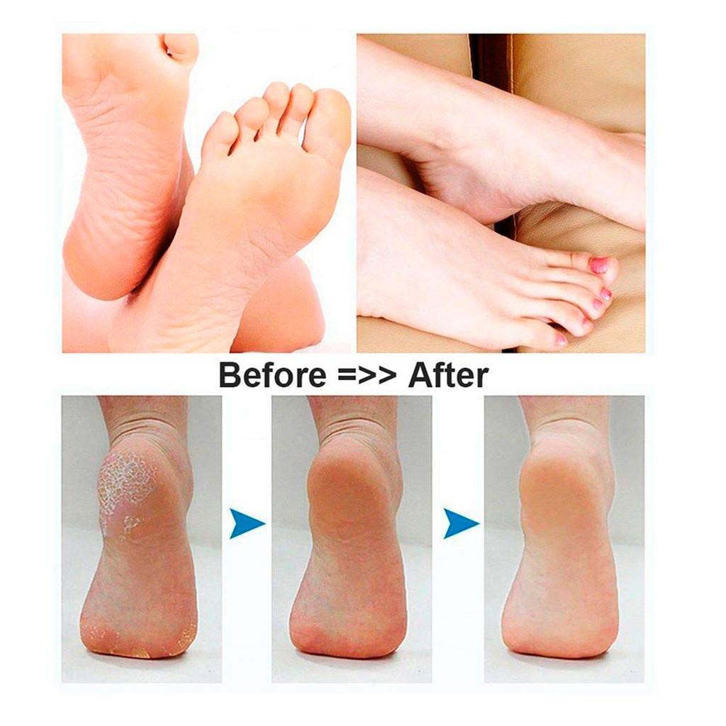 Esfoliador Eletrônico sem Fio para os Pés Vivitar PG-V011R